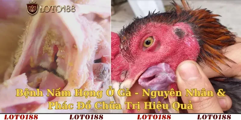 bệnh nấm họng